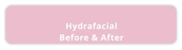 HydrafacialBefore & After